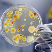 Clean culture of aerobic bacteria on agar plate, biohazard sign in background. Selective focus on petri dish, slightly blue toned, AdobeRGB color profile. Content of my lightbox medical & sciences: